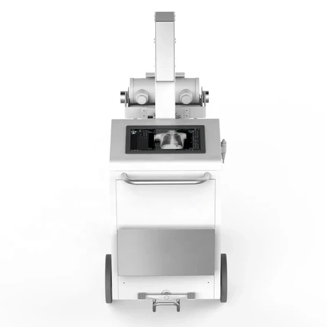 32KW Mobile Digital Radiography System